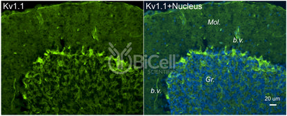 KCNA1 (Kv1.1) Antibody - FFPE Validated