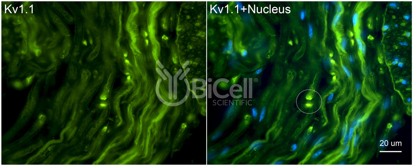 KCNA1 (Kv1.1) Antibody - FFPE Validated