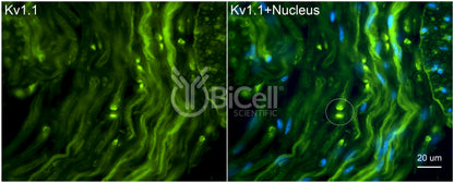 KCNA1 (Kv1.1) Antibody - FFPE Validated