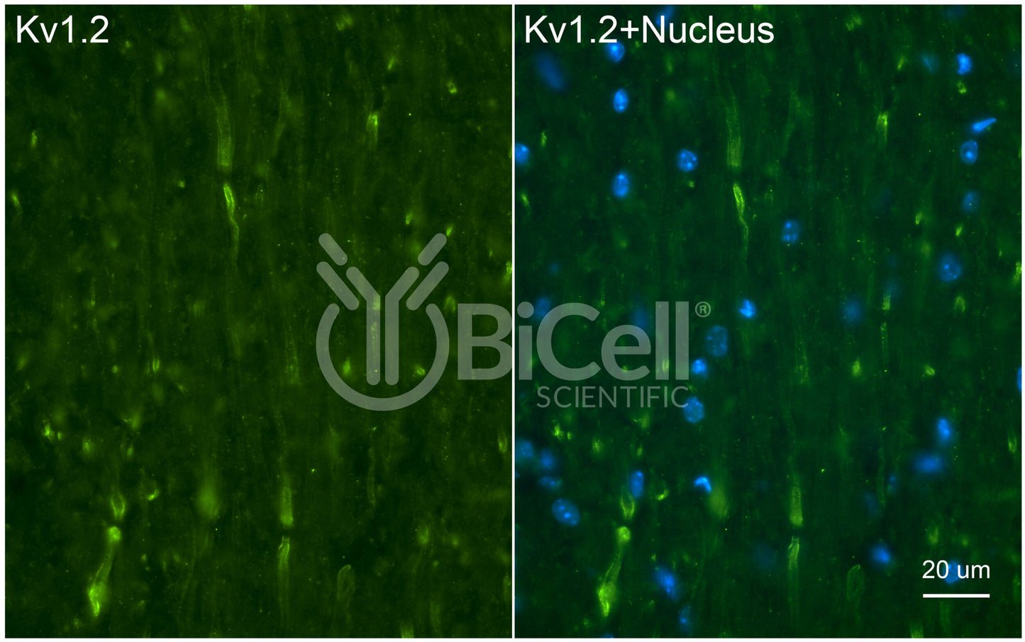 KCNA2 (Kv1.2) Antibody