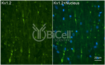 KCNA2 (Kv1.2) Antibody