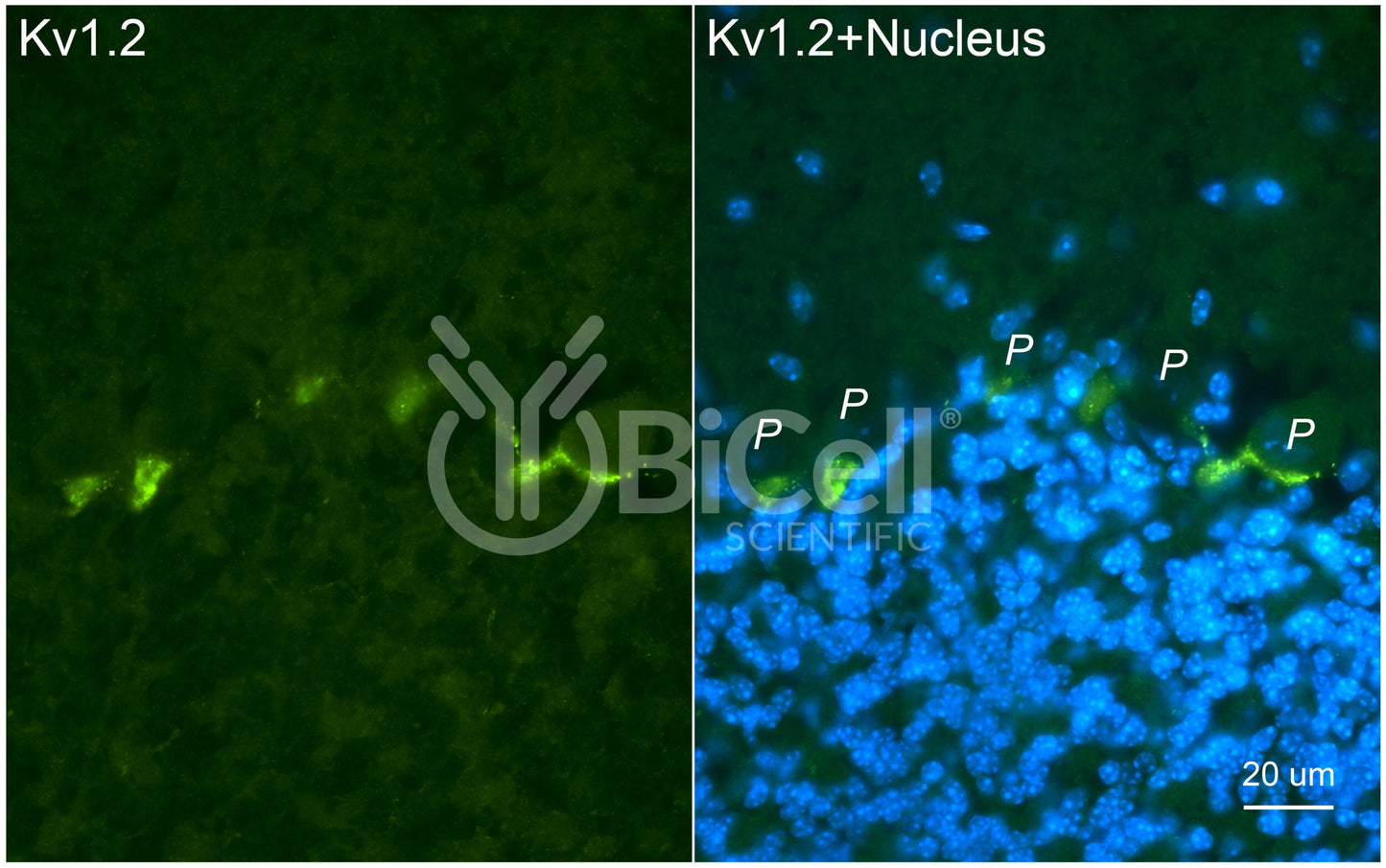 KCNA2 (Kv1.2) Antibody - Western Blot Validated