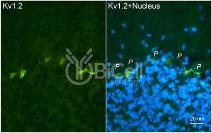 KCNA2 (Kv1.2) Antibody