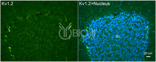 KCNA2 (Kv1.2) Antibody - Western Blot Validated