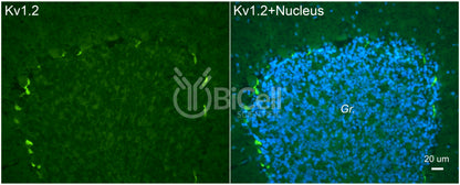 KCNA2 (Kv1.2) Antibody