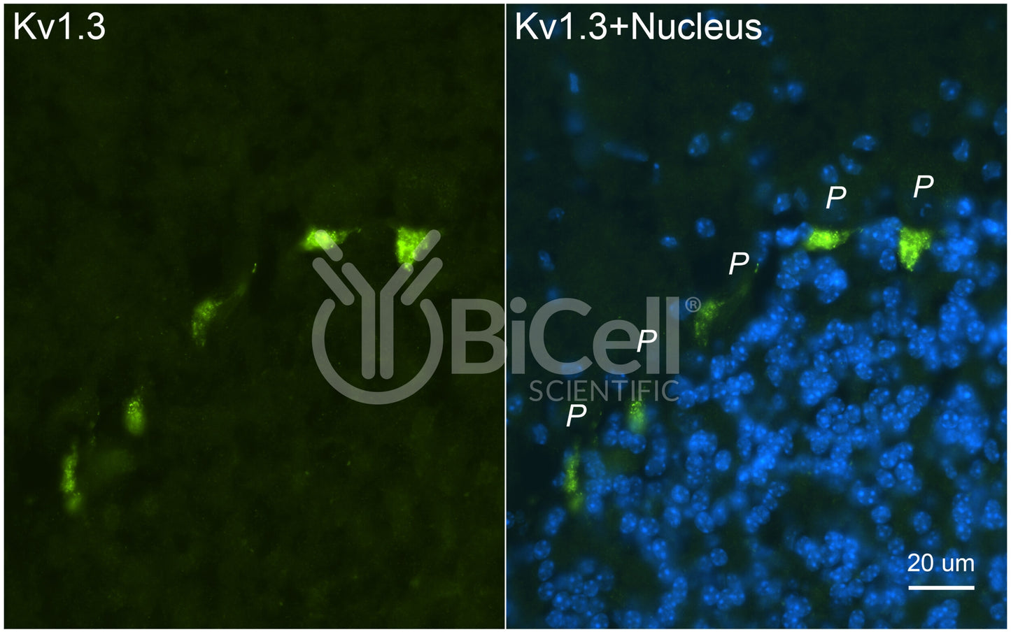 KCNA3 (Kv1.3) Antibody - Western Blot Validated