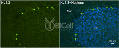 KCNA3 (Kv1.3) Antibody - FFPE Validated