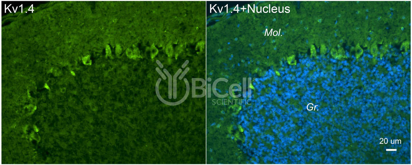 KCNA4 (Kv1.4) Antibody - FFPE Validated