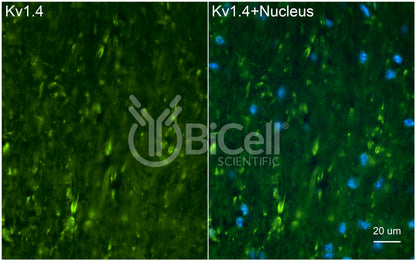 KCNA4 (Kv1.4) Antibody - FFPE Validated