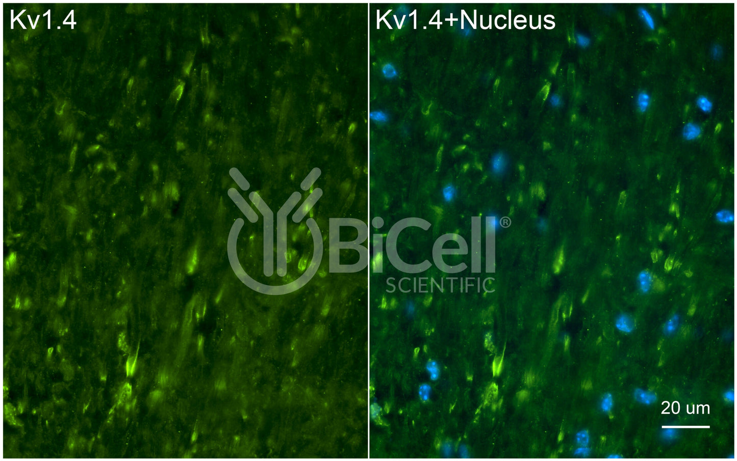 KCNA4 (Kv1.4) Antibody