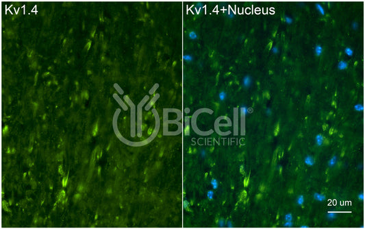 KCNA4 (Kv1.4) Antibody
