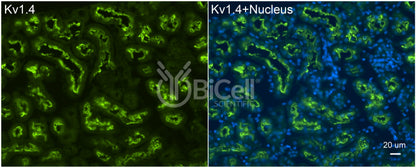 KCNA4 (Kv1.4) Antibody - Western Blot Validated