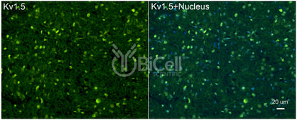 KCNA5 (Kv1.5) Antibody - FFPE Validated