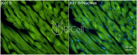 KCNA5 (Kv1.5) Antibody - Western Blot Validated