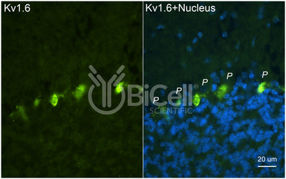 KCNA6 (Kv1.6) Antibody