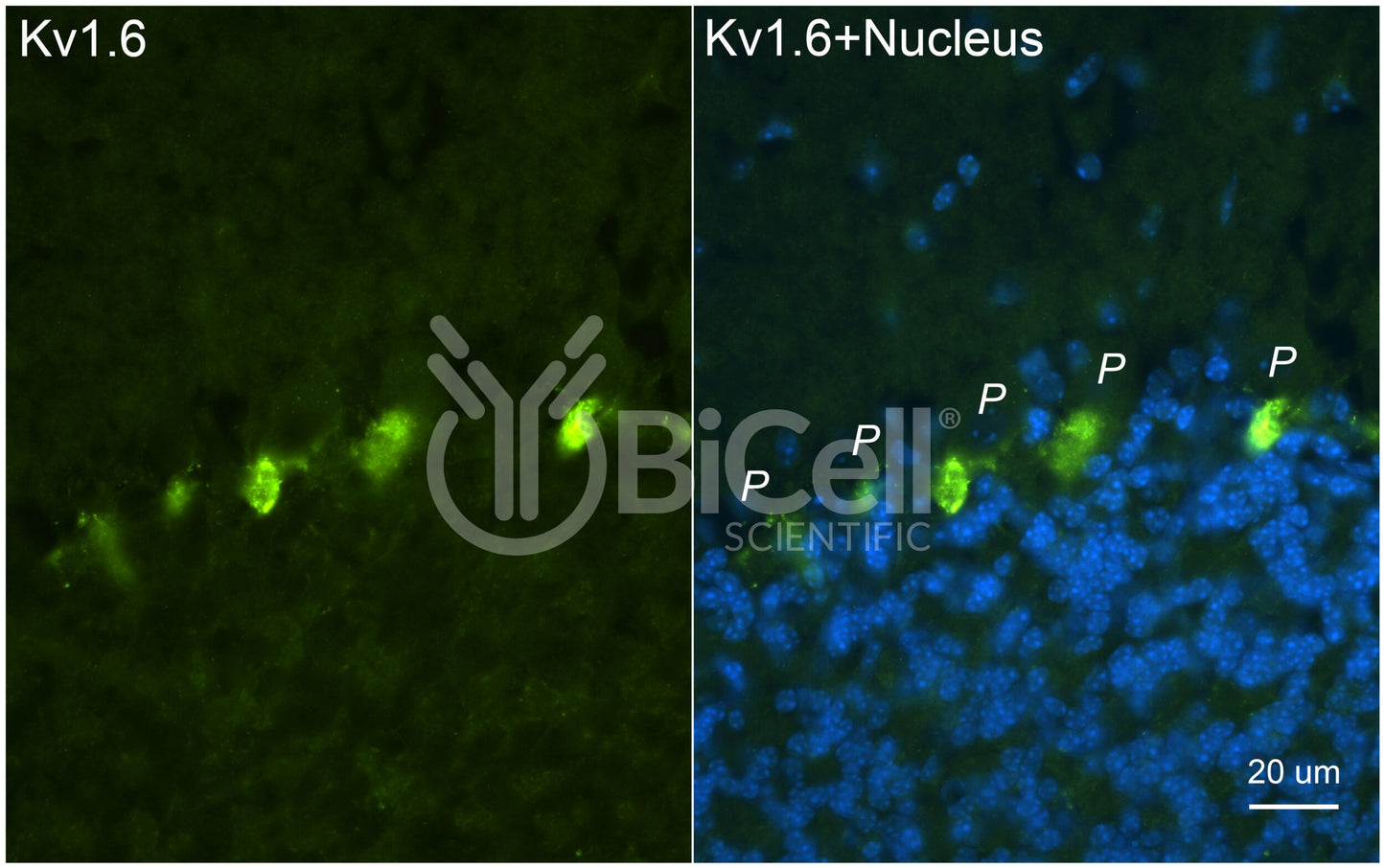 KCNA6 (Kv1.6) Antibody - FFPE Validated