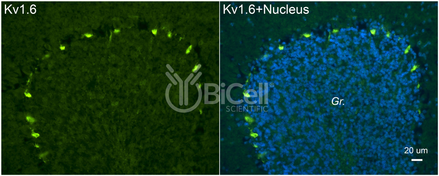 KCNA6 (Kv1.6) Antibody - FFPE Validated