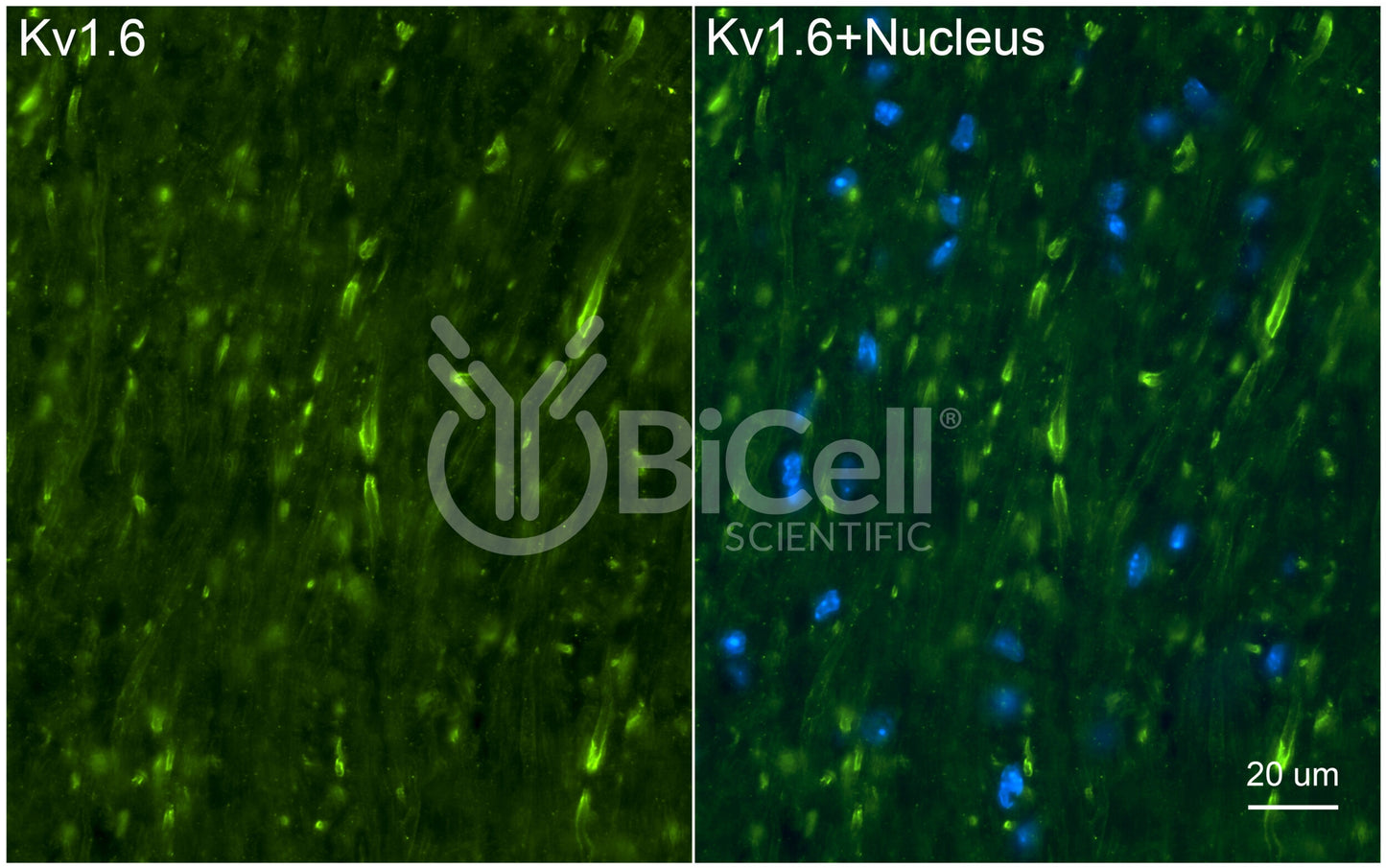 KCNA6 (Kv1.6) Antibody - FFPE Validated