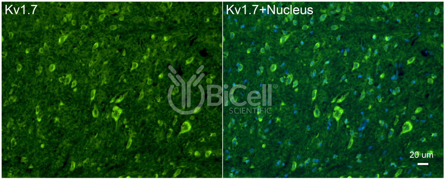 KCNA7 (Kv1.7) Antibody - FFPE Validated