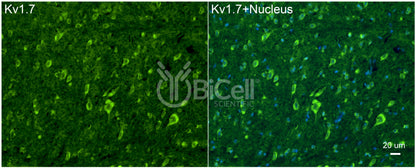 KCNA7 (Kv1.7) Antibody - FFPE Validated