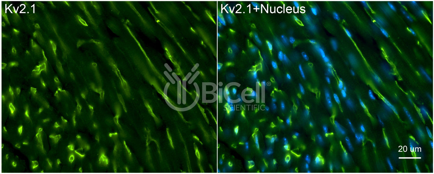 KCNB1 (Kv2.1) Antibody - FFPE Validated