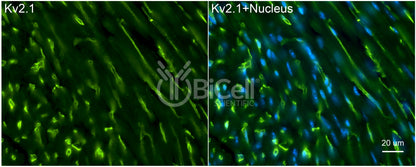KCNB1 (Kv2.1) Antibody - FFPE Validated
