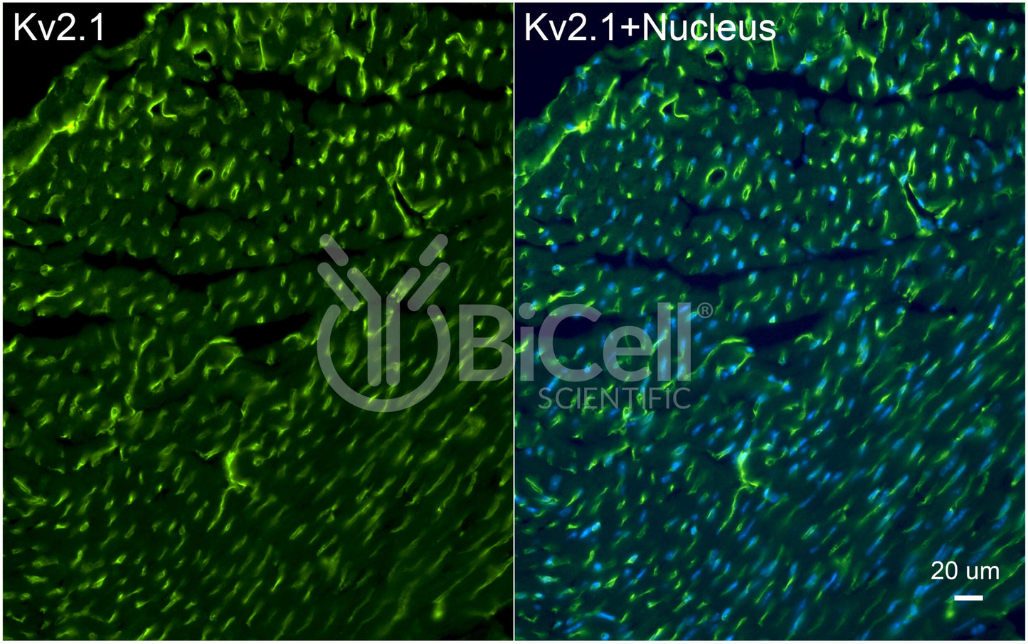 KCNB1 (Kv2.1) Antibody - FFPE Validated