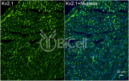 KCNB1 (Kv2.1) Antibody - FFPE Validated