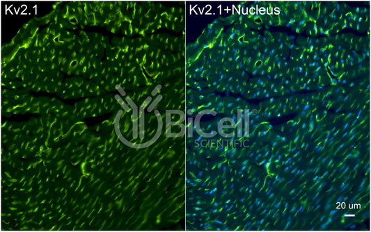 KCNB1 (Kv2.1) Antibody - FFPE Validated