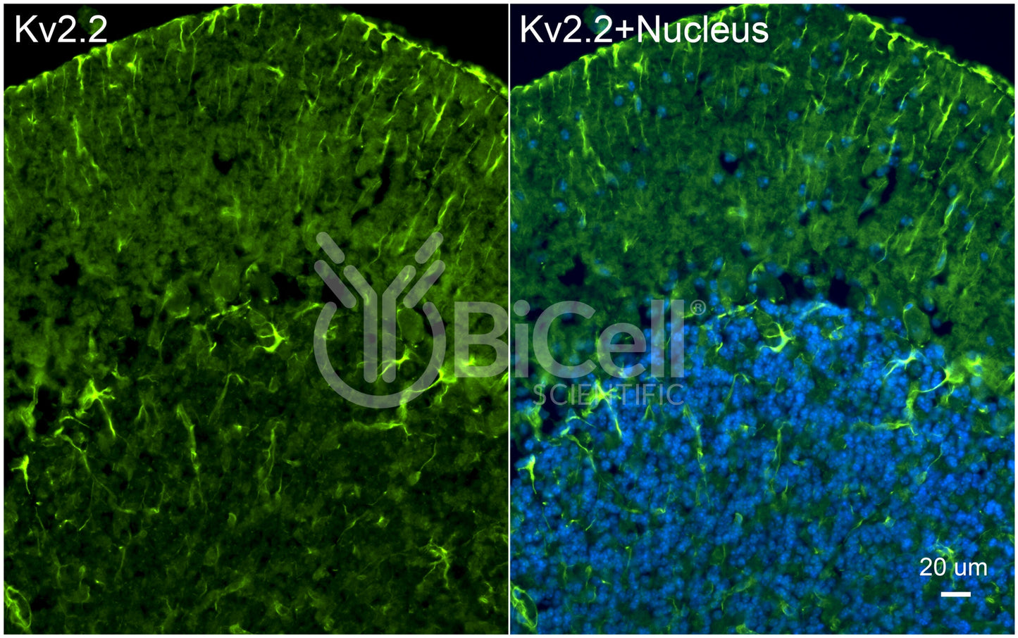 KCNB2 (Kv2.2) Antibody - Western Blot Validated