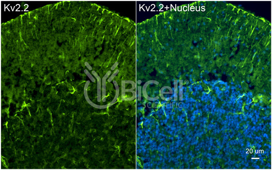 KCNB2 (Kv2.2) Antibody - Western Blot Validated