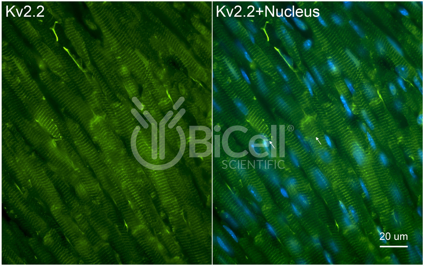 KCNB2 (Kv2.2) Antibody
