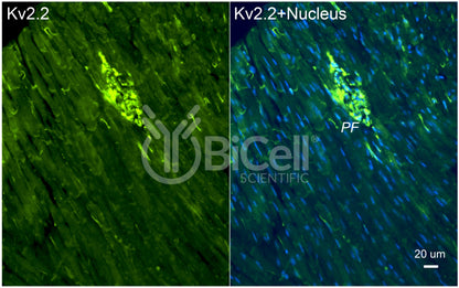 KCNB2 (Kv2.2) Antibody