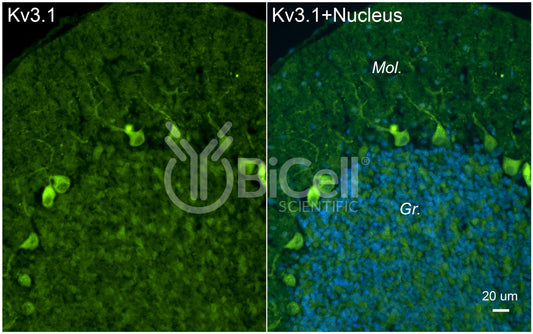 KCNC1 (Kv3.1) Antibody - Western Blot Validated