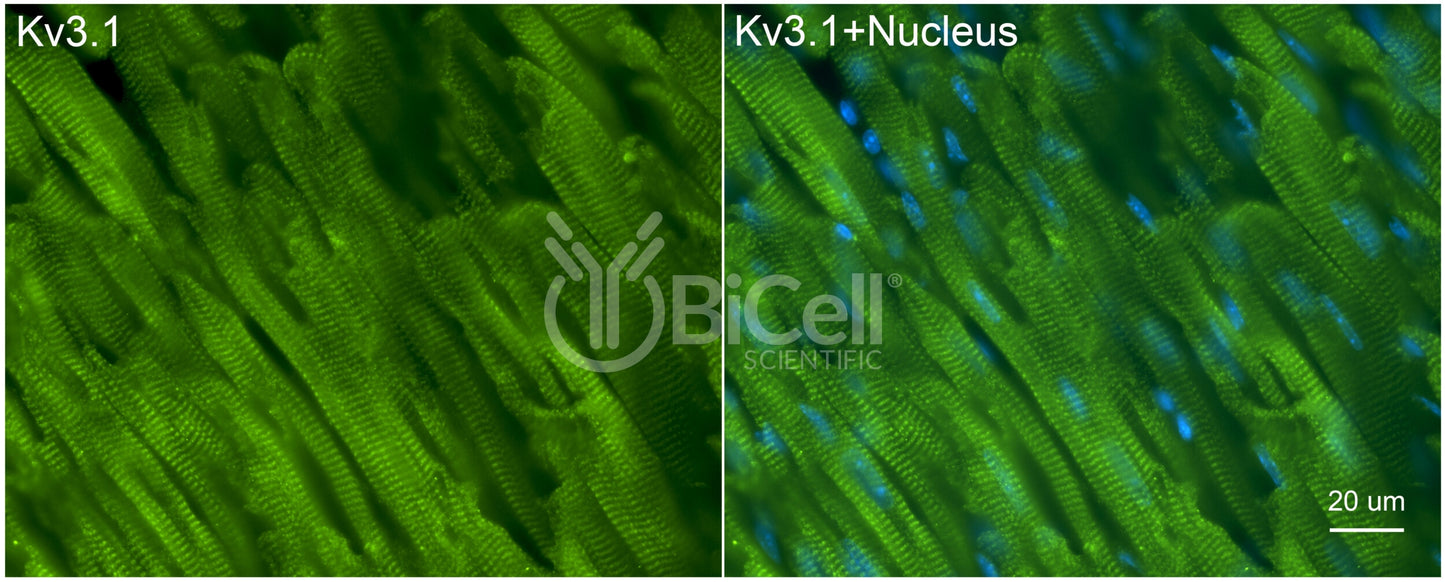 KCNC1 (Kv3.1) Antibody - FFPE Validated