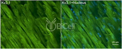 KCNC1 (Kv3.1) Antibody