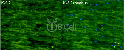 KCNC2 (Kv3.2) Antibody - Western Blot Validated