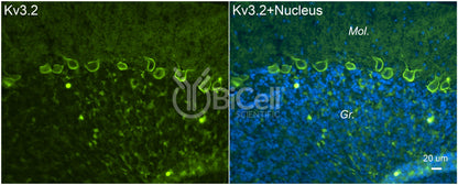 KCNC2 (Kv3.2) Antibody - Western Blot Validated