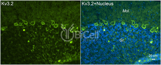 KCNC2 (Kv3.2) Antibody
