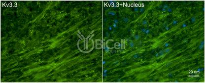 KCNC3 (Kv3.3) Antibody - Western Blot Validated