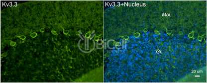 KCNC3 (Kv3.3) Antibody - FFPE Validated