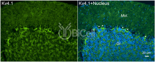 KCND1 (Kv4.1) Antibody