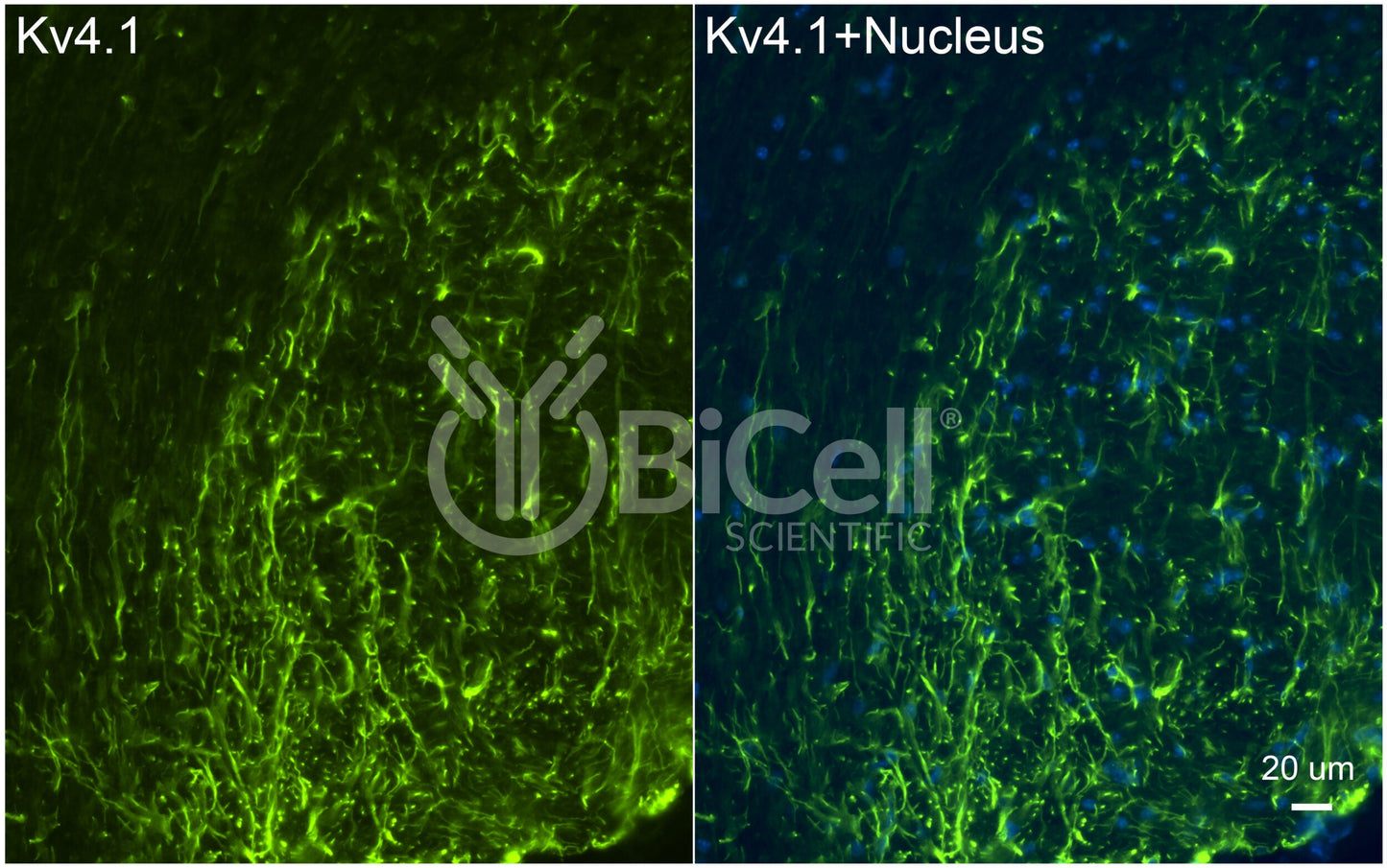 KCND1 (Kv4.1) Antibody - Western Blot Validated