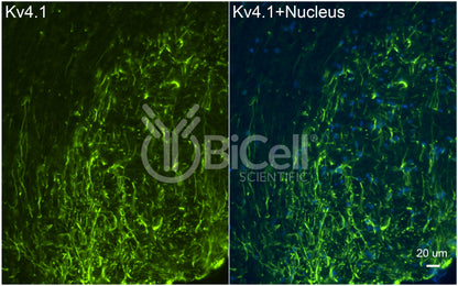 KCND1 (Kv4.1) Antibody - Western Blot Validated