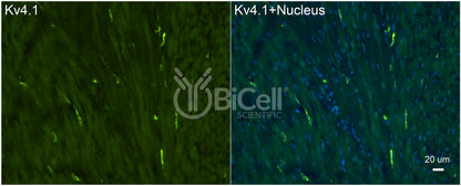 KCND1 (Kv4.1) Antibody - Western Blot Validated
