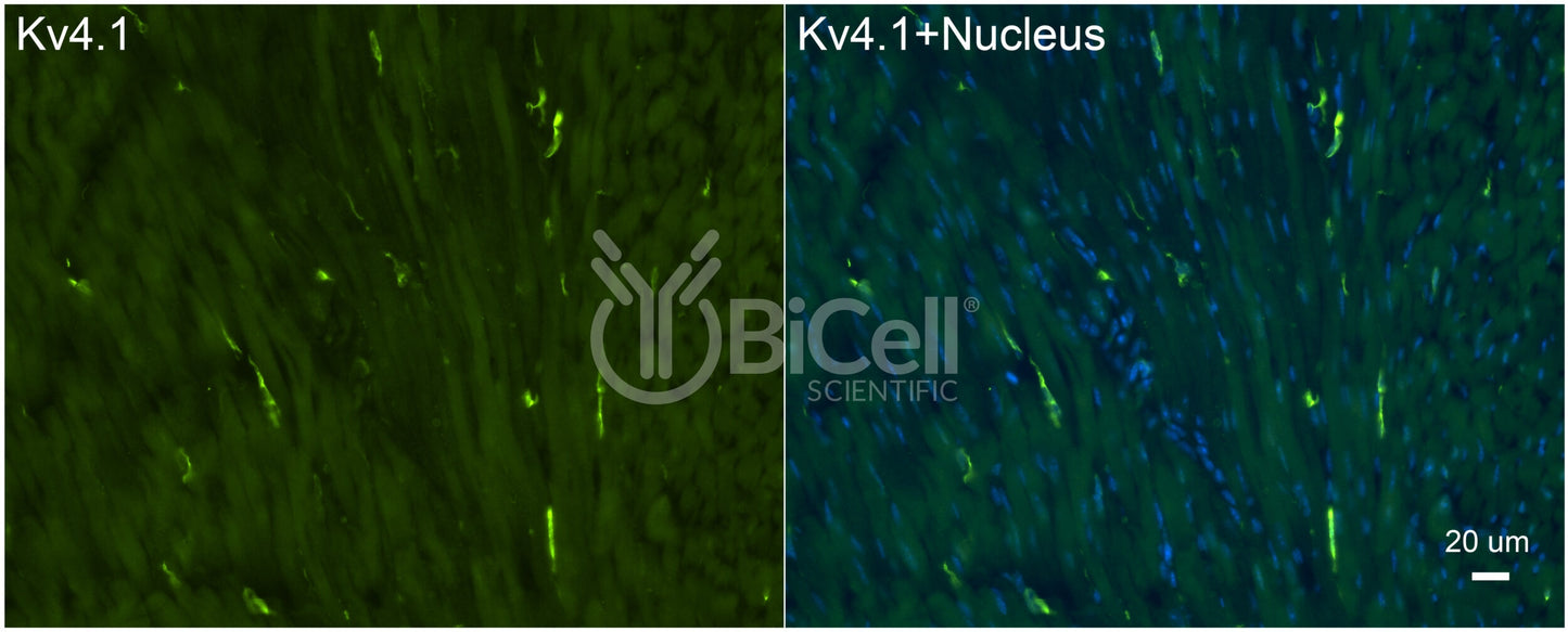 KCND1 (Kv4.1) Antibody