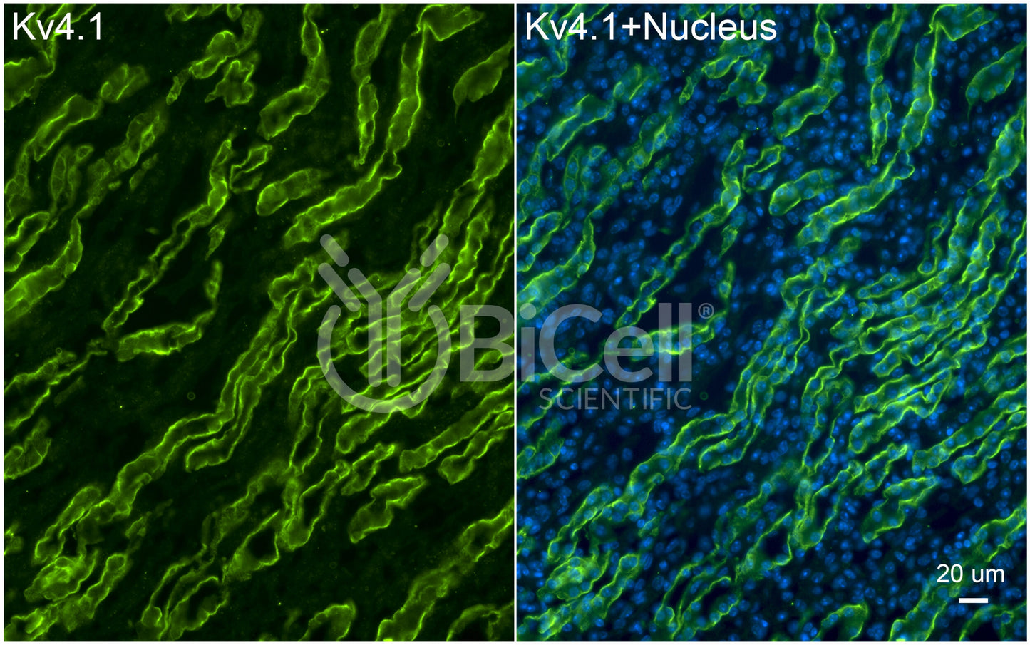 KCND1 (Kv4.1) Antibody - FFPE Validated