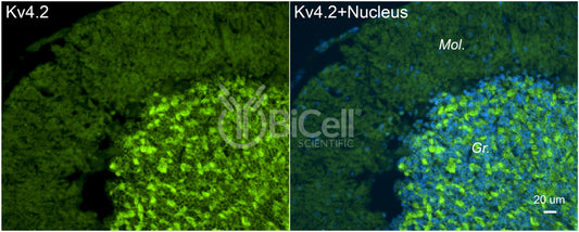 KCND2 (Kv4.2) Antibody
