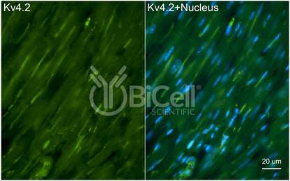 KCND2 (Kv4.2) Antibody - Western Blot Validated
