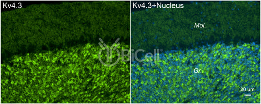 KCND3 (Kv4.3) Antibody